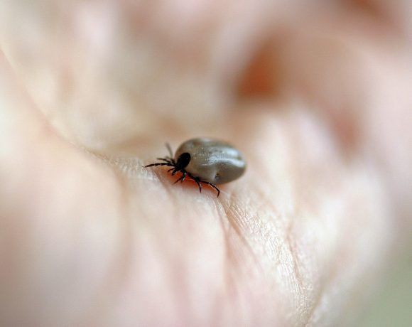 Likwidacja skutków ukąszeń przez meszki, komary, mrówki i kleszcze